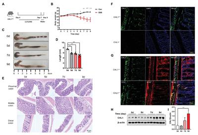 Close Homolog of L1 Deficiency Exacerbated Intestinal Epithelial Barrier Function in Mouse Model of Dextran Sulfate Sodium-Induced Colitis